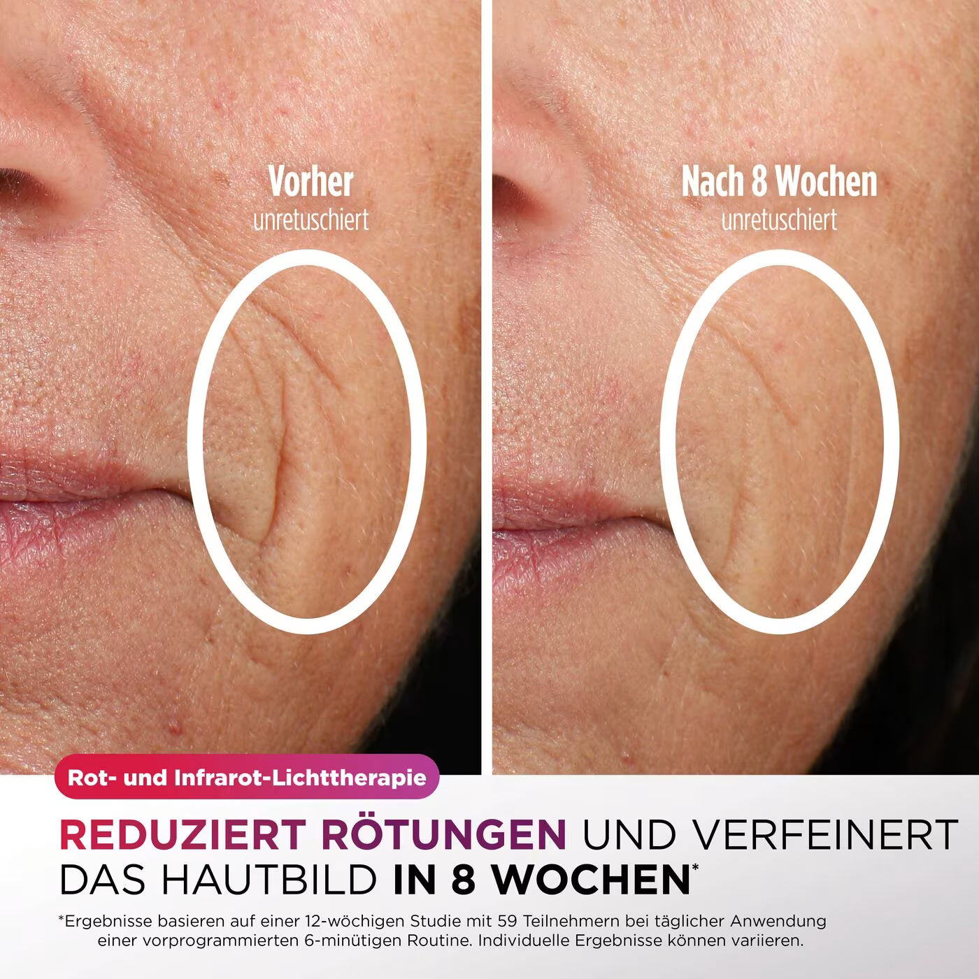 Shark CryoGlow LED-Maske + Kühlung der Augenpartie