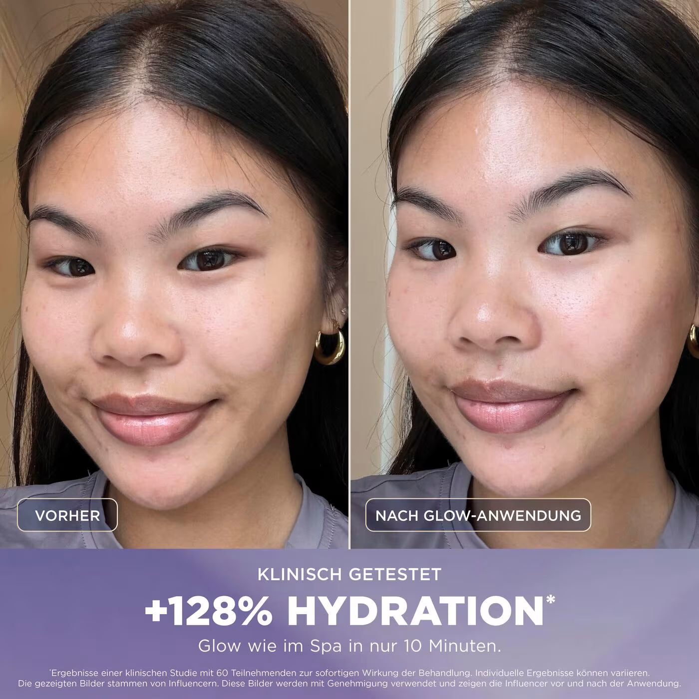 Shark FacialPro Glow + DePuffi Hydro-Powered Facial System für zu Hause – Schwarz