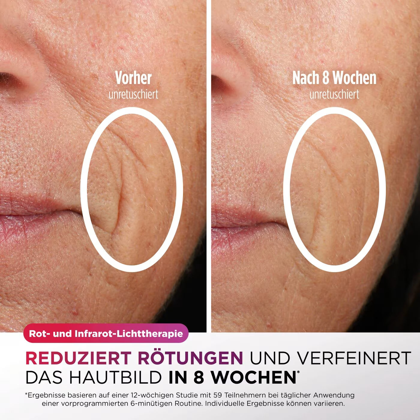 Shark CryoGlow LED-Maske + Kühlung der Augenpartie