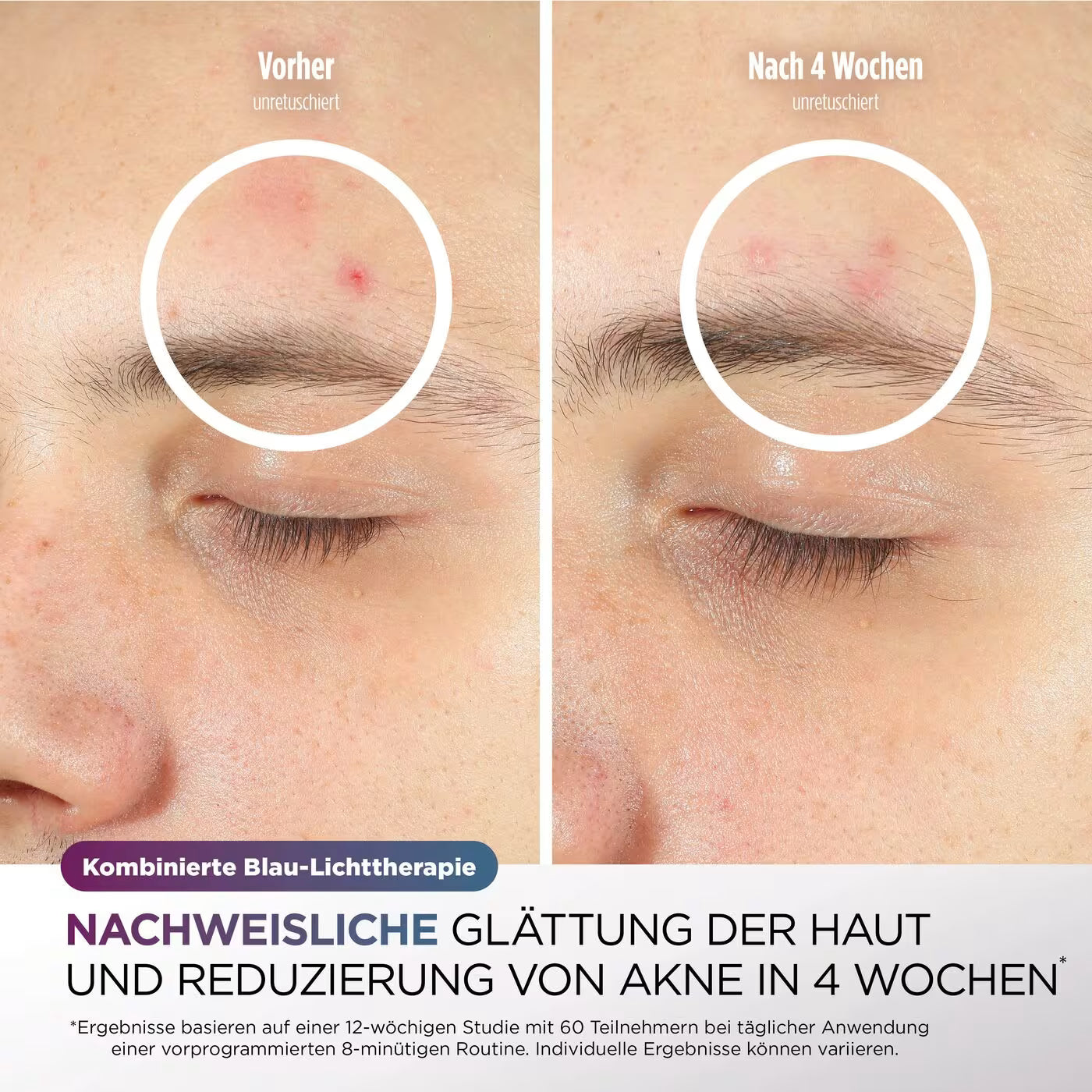 Shark CryoGlow LED-Maske + Kühlung der Augenpartie