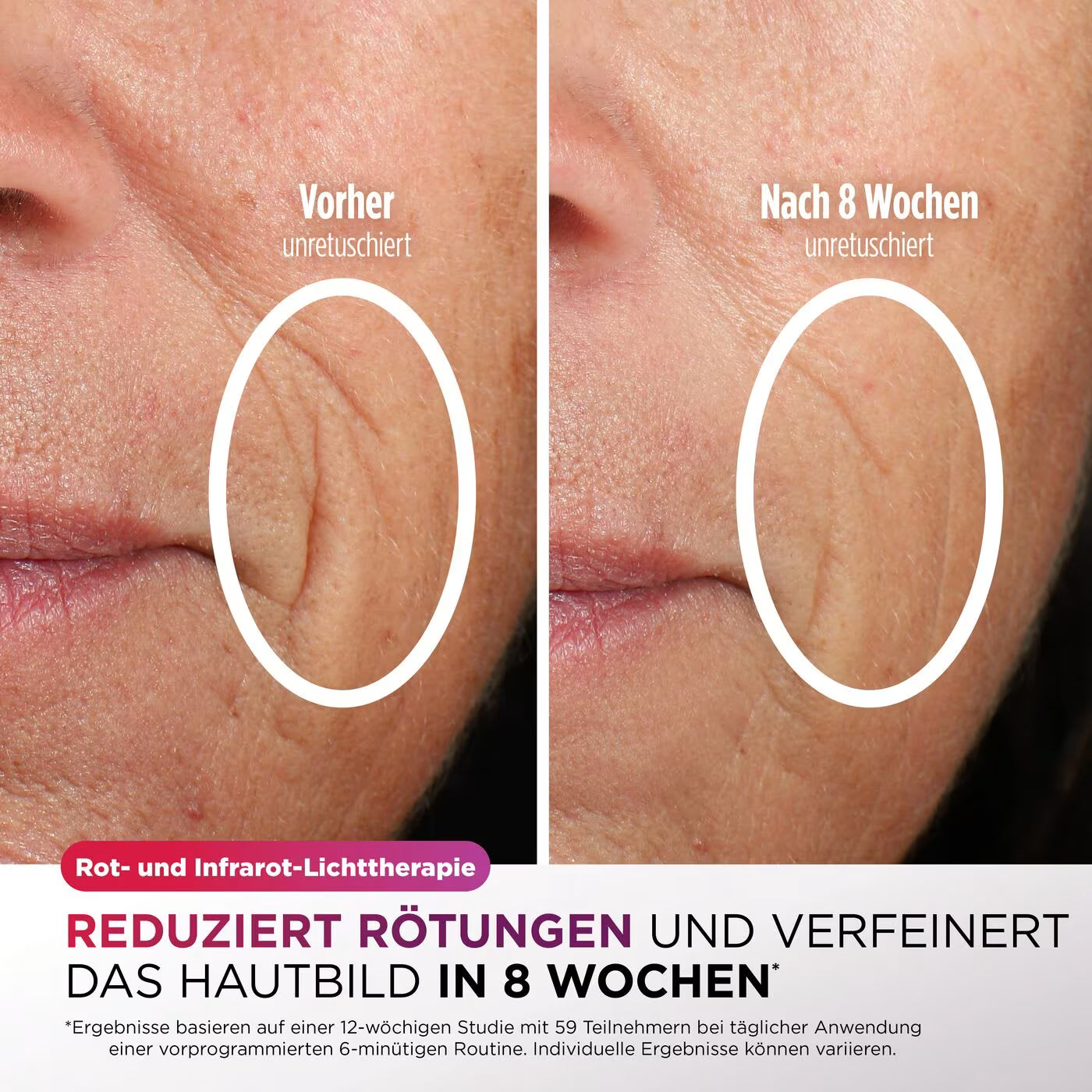 Shark CryoGlow LED-Maske + Kühlung der Augenpartie