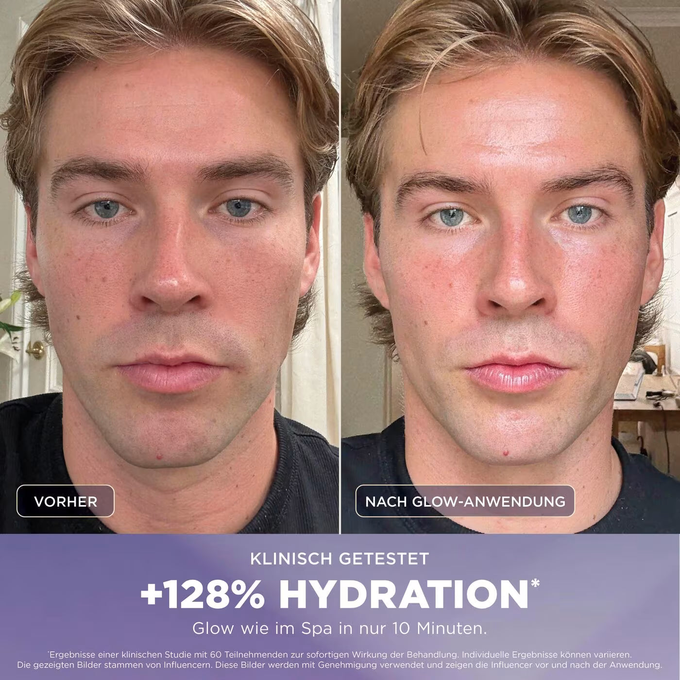 Shark FacialPro Glow + DePuffi Hydro-Powered Facial System für zu Hause – Spa Blau